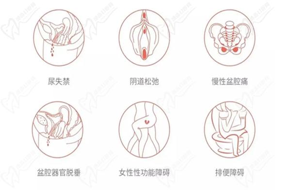 MEC 3D生物束帶微創(chuàng)緊縮術的優(yōu)勢在于