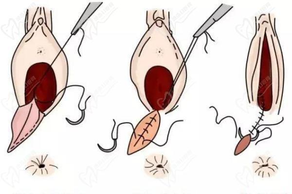 上海九龍醫(yī)院潘麗琴女性私密價格表