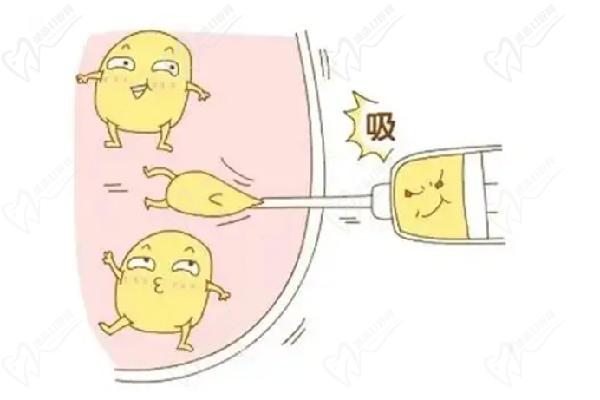 哈爾濱羽禪醫(yī)美楊宇梓腰腹環(huán)吸真實實例分享