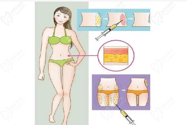 哈爾濱羽禪醫(yī)美楊宇梓口碑評價與就診指南