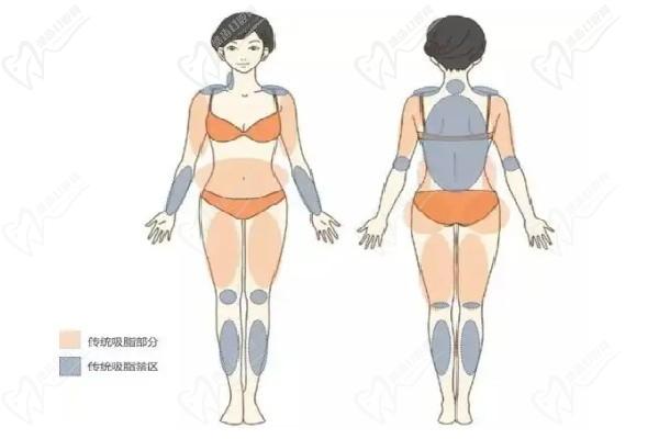 哈爾濱羽禪醫(yī)美楊宇梓做腰腹環(huán)吸怎么樣？口碑技術(shù)靠譜價(jià)格實(shí)惠看吸脂優(yōu)勢(shì)